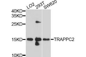 Western blot analysis of extracts of various cell lines, using TRAPPC2 antibody (ABIN5999090) at 1/1000 dilution. (TRAPPC2 抗体)
