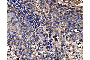 IHC analysis of CPS1 using anti-CPS1 antibody (ABIN7599871).