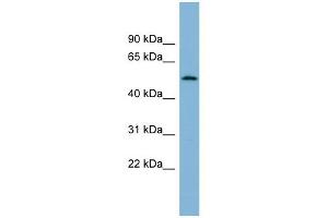 C2ORF29 antibody used at 1 ug/ml to detect target protein. (CNOT11 抗体  (N-Term))