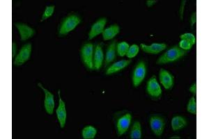 Immunofluorescent analysis of A549 cells using ABIN7173039 at dilution of 1:100 and Alexa Fluor 488-congugated AffiniPure Goat Anti-Rabbit IgG(H+L) (TMEM120B 抗体  (AA 1-101))