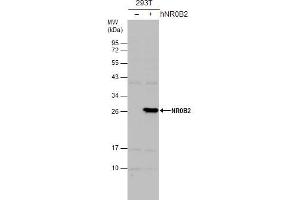 WB Image Non-transfected (–) and transfected (+) 293T whole cell extracts (30 μg) were separated by 12% SDS-PAGE, and the membrane was blotted with NR0B2 antibody [N2C3] , diluted at 1:500. (NR0B2 抗体)