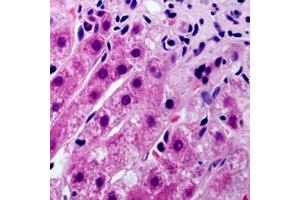 Immunohistochemistry (IHC) image for anti-Cytochrome P450, Family 21, Subfamily A, Polypeptide 2 (CYP21A2) (Center) antibody (ABIN7300592)