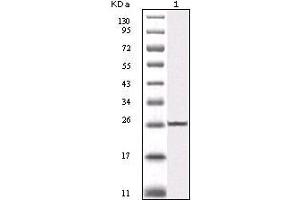 Western blot analysis using IKBKB mouse mAb against truncated IKBKB recombinant protein (1). (IKBKB 抗体)