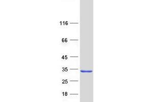 Western Blotting (WB) image for rho Family GTPase 1 (RND1) protein (Myc-DYKDDDDK Tag) (ABIN2731003)