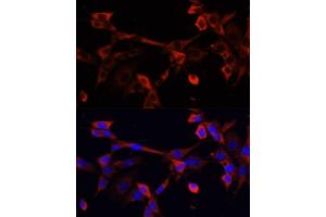 Immunofluorescence analysis of NIH/3T3 cells using DNL1 antibody (ABIN6130967, ABIN6139736, ABIN6139738 and ABIN6217037) at dilution of 1:100. (DNASEX 抗体  (AA 1-302))