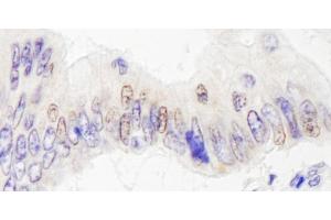 anti-Lysine (K)-Specific Demethylase 4A (KDM4A) (AA 350-400) antibody