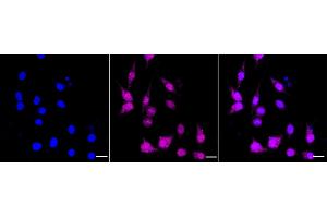 anti-Prolyl Endopeptidase Like Protein (PREPL) antibody