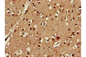 Immunohistochemistry of paraffin-embedded human brain tissue using ABIN7147395 at dilution of 1:100 (C3orf34 抗体  (AA 1-163))