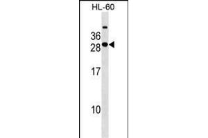 STXBP6 Antibody (Center) (ABIN1538584 and ABIN2849443) western blot analysis in HL-60 cell line lysates (35 μg/lane). (STXBP6 抗体  (AA 71-97))