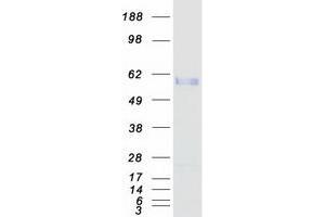 Validation with Western Blot