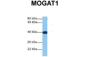 Host:  Rabbit  Target Name:  MOGAT1  Sample Tissue:  Human Fetal Liver  Antibody Dilution:  1. (MOGAT1 抗体  (C-Term))