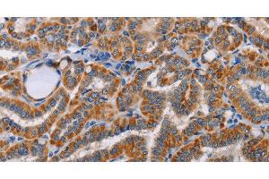 Immunohistochemistry of paraffin-embedded Human brain tissue using ALG9 Polyclonal Antibody at dilution 1:60 (ALG9 抗体)
