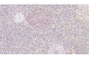 Detection of MMP7 in Human Spleen Tissue using Monoclonal Antibody to Matrix Metalloproteinase 7 (MMP7) (MMP7 抗体  (AA 18-267))