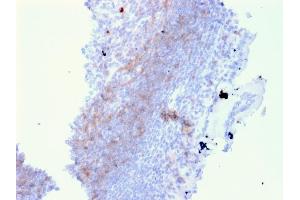 Formalin-fixed, paraffin-embedded human Lymph Node in Colon stained with CD72 Mouse Monoclonal Antibody (BU40). (CD72 抗体)