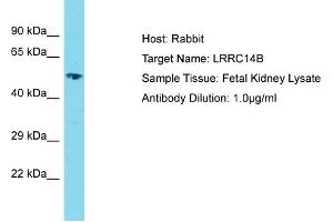 Host: Rabbit Target Name: LRRC14B Sample Type: Fetal Kidney lysates Antibody Dilution: 1. (LRRC14B 抗体  (C-Term))