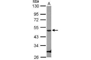 WB Image Sample (30 ug of whole cell lysate) A: U87-MG 10% SDS PAGE antibody diluted at 1:1000 (Cyclin E1 抗体  (C-Term))