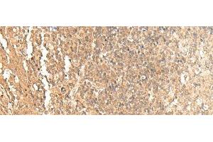 Immunohistochemistry of paraffin-embedded Human tonsil tissue using GTF3A Polyclonal Antibody at dilution of 1:60(x200) (GTF3A 抗体)