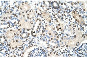 Human kidney; AKAP8L antibody - C-terminal region in Human kidney cells using Immunohistochemistry (AKAP8L 抗体  (C-Term))