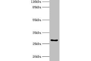 Western blot All lanes: HOXA6 antibody at 2 μg/mL + Mouse heart tissue Secondary Goat polyclonal to rabbit IgG at 1/10000 dilution Predicted band size: 27 kDa Observed band size: 27 kDa (HOXA6 抗体  (AA 1-233))