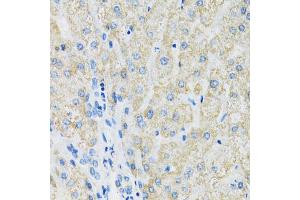 Immunohistochemistry of paraffin-embedded human liver using SLC19A1 antibody (ABIN6291462) at dilution of 1:100 (40x lens). (SLC19A1 抗体)
