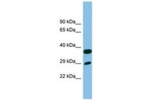 Image no. 1 for anti-Receptor (Chemosensory) Transporter Protein 4 (RTP4) (AA 107-156) antibody (ABIN6745178) (RTP4 抗体  (AA 107-156))