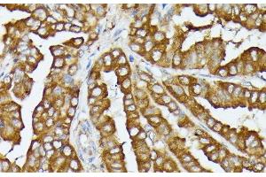 Immunohistochemistry (Paraffin-embedded Sections) (IHC (p)) image for anti-Cytochrome C Oxidase Assembly Homolog 15 (COX15) antibody (ABIN7258036)