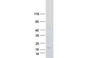 Validation with Western Blot