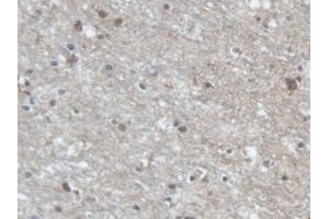 Detection of PCDHa1 in Human Cerebrum Tissue using Polyclonal Antibody to Protocadherin Alpha 1 (PCDHa1) (PCDHA1 抗体  (AA 30-242))