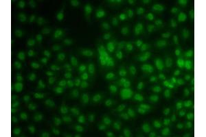 Immunofluorescence analysis of  cells using KLF3 antibody (ABIN6130892, ABIN6142918, ABIN6142919 and ABIN6223018).