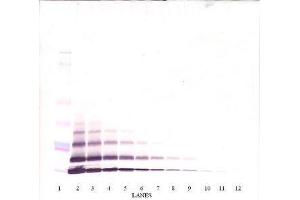 Image no. 3 for anti-Chemokine (C-X-C Motif) Ligand 5 (CXCL5) antibody (ABIN465535)