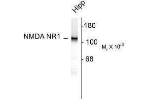 Western Blotting (WB) image for anti-NMDA Receptor 1 (NMDA R1) (AA 1-564), (N-Term) antibody (ABIN371829) (NMDA 1 Receptor 抗体  (N-Term))