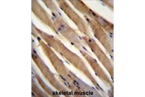 USP50 Antibody (Center) immunohistochemistry analysis in formalin fixed and paraffin embedded human skeletal muscle followed by peroxidase conjugation of the secondary antibody and DAB staining. (USP50 抗体  (Middle Region))