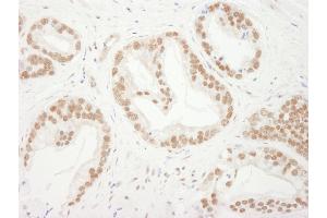 Immunohistochemistry (IHC) image for anti-Budding Uninhibited By Benzimidazoles 3 Homolog (Yeast) (BUB3) (AA 275-325) antibody (ABIN7449397) (BUB3 抗体  (AA 275-325))