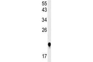 Western blot analysis of IMP3 antibody and HeLa lysate. (IMP3 抗体  (AA 156-184))