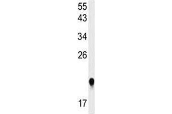IMP3 antibody  (AA 156-184)
