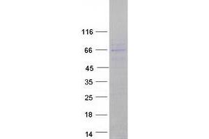 Western Blotting (WB) image for CCR4-NOT Transcription Complex, Subunit 6-Like (CNOT6L) protein (Myc-DYKDDDDK Tag) (ABIN2713329)