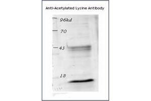 Image no. 2 for anti-Acetylated Lysine (acetylated) antibody (ABIN264880) (Acetylated Lysine 抗体  (acetylated))