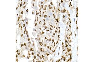 Immunohistochemistry of paraffin-embedded rat lung using XRCC2 Rabbit pAb  at dilution of 1:50 (40x lens). (XRCC2 抗体)
