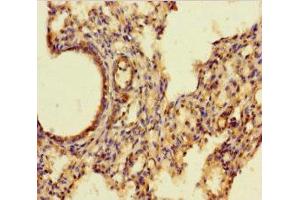 Immunohistochemistry of paraffin-embedded human lung tissue using ABIN7143728 at dilution of 1:100 (Iba1 抗体  (AA 2-147))