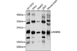 Western blot analysis of extracts of various cell lines, using RA antibody (ABIN7269818) at 1:1000 dilution. (RAB9A 抗体  (AA 1-201))