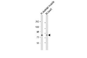 Western blot analysis of anti-Leo1 Antibody (N-term) (ABIN388697 and ABIN2838783) in HL60 cell line lysates (35 μg/lane). (LEO1 抗体  (N-Term))