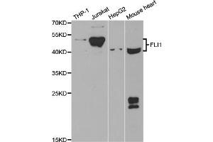Western blot analysis of extracts of various cell lines, using FLI1 antibody (ABIN5973290) at 1/1000 dilution. (FLI1 抗体)