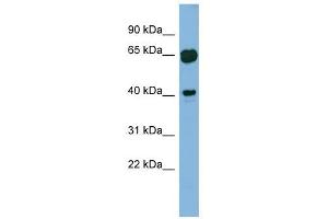 RAB3IL1 antibody used at 1 ug/ml to detect target protein. (RAB3IL1 抗体)
