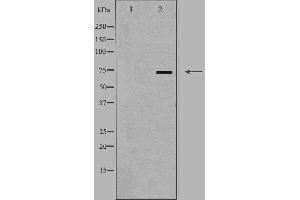 Western blot analysis of extracts from K562 cells, using SLC44A1 antibody. (SLC44A1 抗体  (Internal Region))