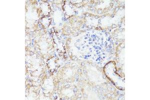 Immunohistochemistry of paraffin-embedded mouse kidney using ErbB2 antibody. (ErbB2/Her2 抗体  (C-Term))