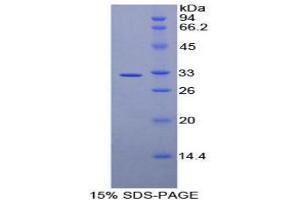SDS-PAGE analysis of Human AMY2 Protein. (AMY2 蛋白)