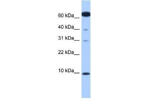 DYNLL2 antibody used at 1 ug/ml to detect target protein. (DYNLL2 抗体  (N-Term))
