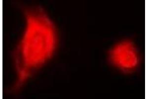 Immunofluorescent analysis of ESE-1 staining in A549 cells. (ELF3 抗体)