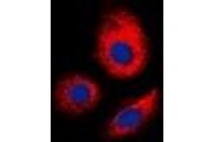 Immunofluorescent analysis of ERGIC3 staining in MCF7 cells. (ERGIC3 抗体  (C-Term))