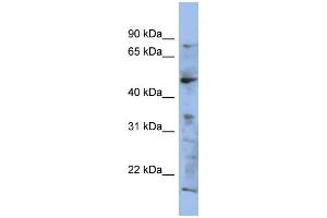 WB Suggested Anti-RAB3IP Antibody Titration: 0. (RAB3IP 抗体  (N-Term))